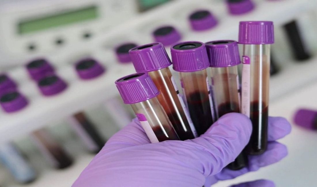 Hematoloji alanında önemli uyarılarda bulunan uzmanlar, rutin kan testlerinde ortaya